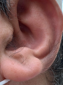 Man With Hairy Ear